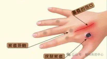 正在上传... image.png